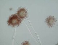 Aspergillus luchuensis顕微鏡写真