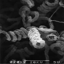 Streptomyces avermitilis MA-4680 電子顕微鏡写真