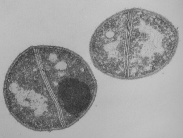 Microlunatus phosphovorus