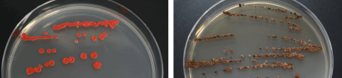 写真(左) Microbispora rosea subsp. nonnitritogenes NBRC 14045、写真(右) Actinophytocola sp. NBRC 14198