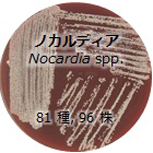 ノカルディア属のモデル写真です