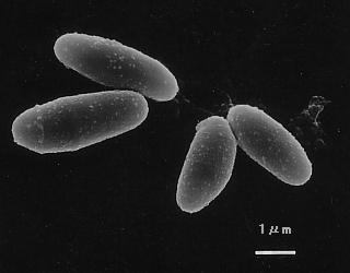 Corynebacterium efficiens YS-314T 電子顕微鏡写真