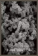 Staphylococcus aureus N315 電子顕微鏡写真
