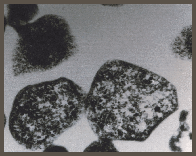 Sulfolobus tokodaii strain7 電子顕微鏡写真