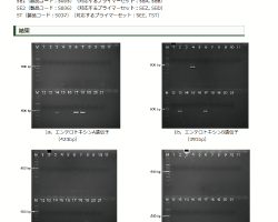 画像:黄色ブドウ球菌のエンテロトキシン毒素遺伝子及び毒素性ショック症候群

毒素遺伝子の検出