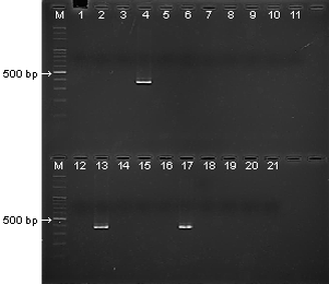 黄色ブドウ球菌のエンテロトキシン毒素遺伝子および毒素性ショック症候群毒素遺伝子の検出