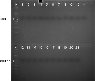 黄色ブドウ球菌のエンテロトキシン毒素遺伝子および毒素性ショック症候群毒素遺伝子の検出