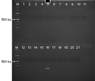 黄色ブドウ球菌のエンテロトキシン毒素遺伝子および毒素性ショック症候群毒素遺伝子の検出