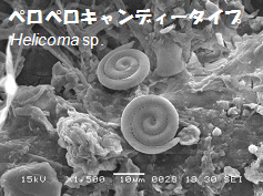ペロペロキャンディータイプの半水生菌の胞子画像