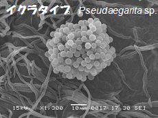 イクラタイプの半水生菌の胞子画像