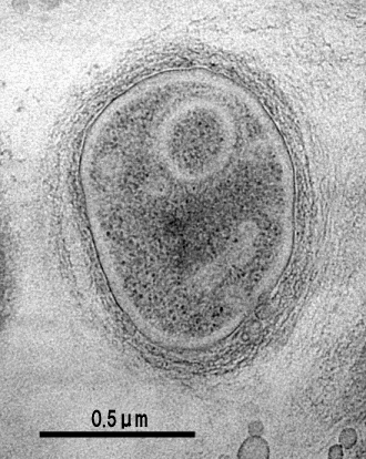 Planctomycetes門のPhycisphaera mikurensis NBRC 102666の電子顕微鏡写真