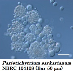 Parietichytrium sarkarianum NBRC 104108 (Bar 50 µm)