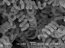 Streptomyces avermitilis NBRC 14893の電子顕微鏡写真
