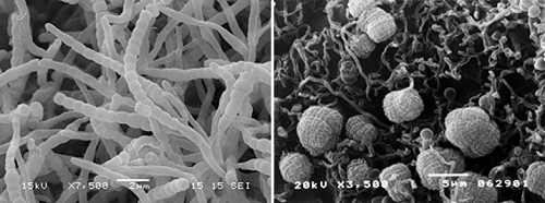左：放線菌の胞子連鎖　右：放線菌の胞子嚢