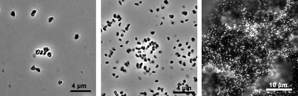 メタン菌顕微鏡写真