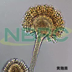 黄麹菌（キコウジカビ）, Aspergillus oryzae NBRC 6215