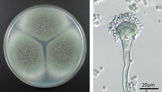 図　エアコンから採取したAspergillus fumigatus（NBRC 113945）