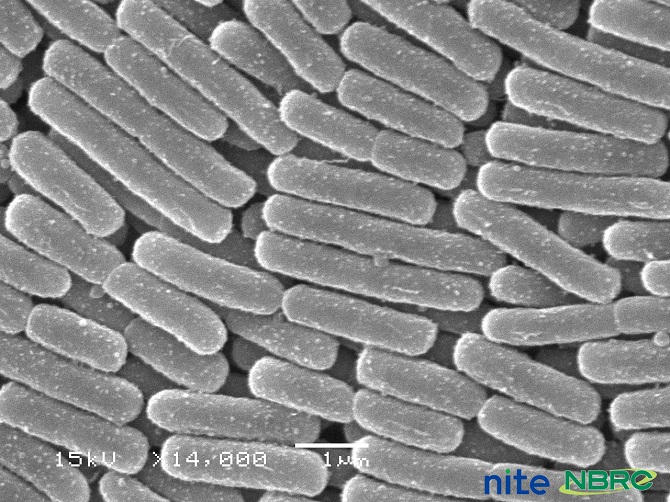 大腸菌, Escherichia coli NBRC 3301_電子顕微鏡2