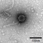 Escherichia coli phage_電子顕微鏡
